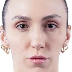 Asli Kalac